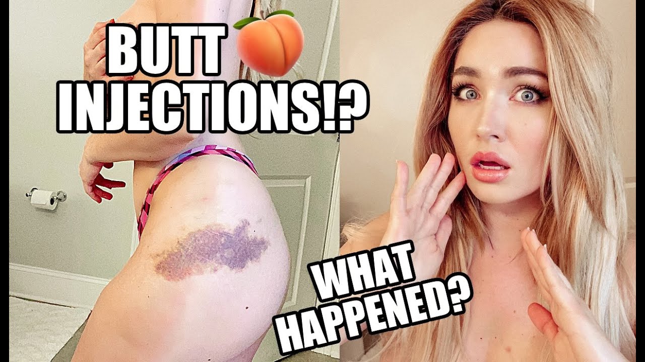 I GOT BUTT INJECTIONS!!! | What Happened!?