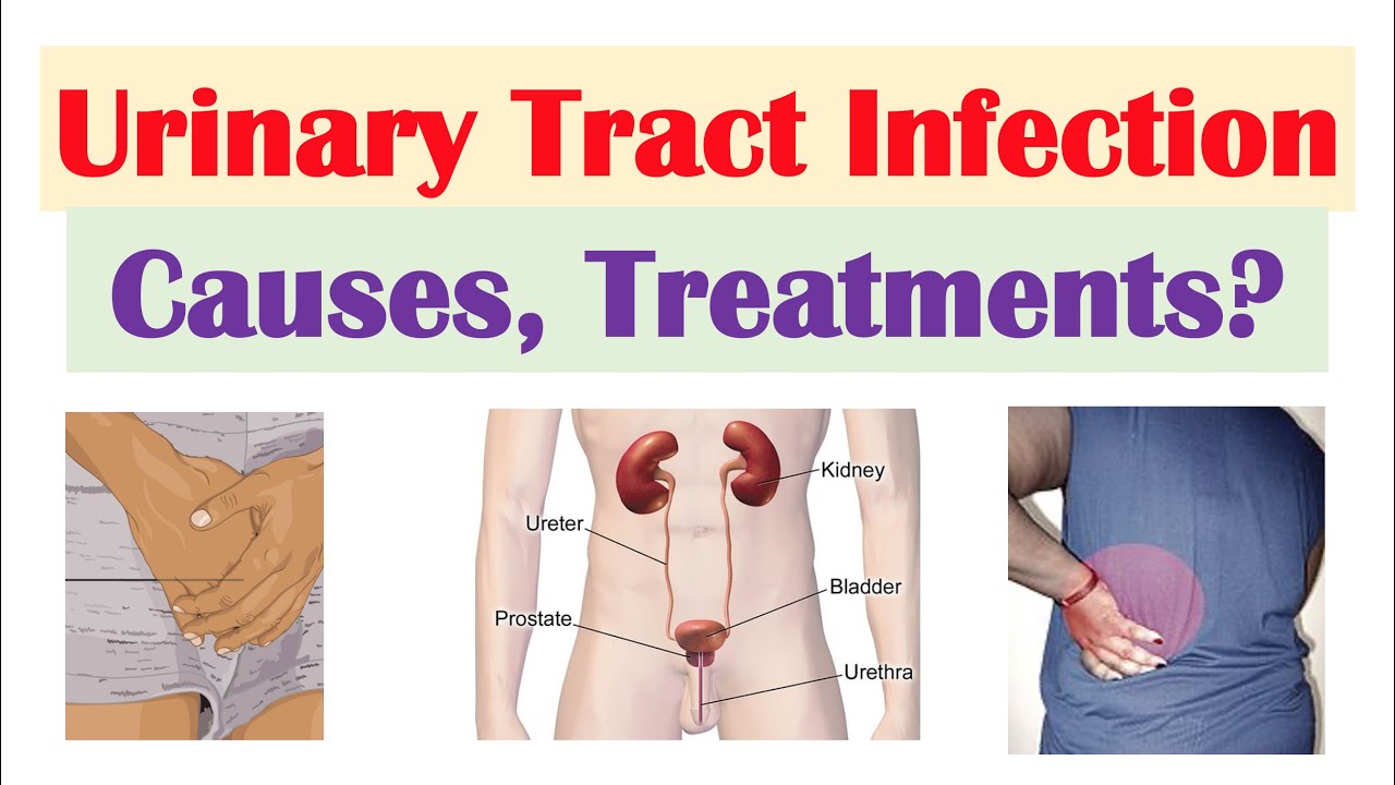 urinary-tract-infections-uti-overview-causes-risk-factors-symptoms-diagnosis-treatment