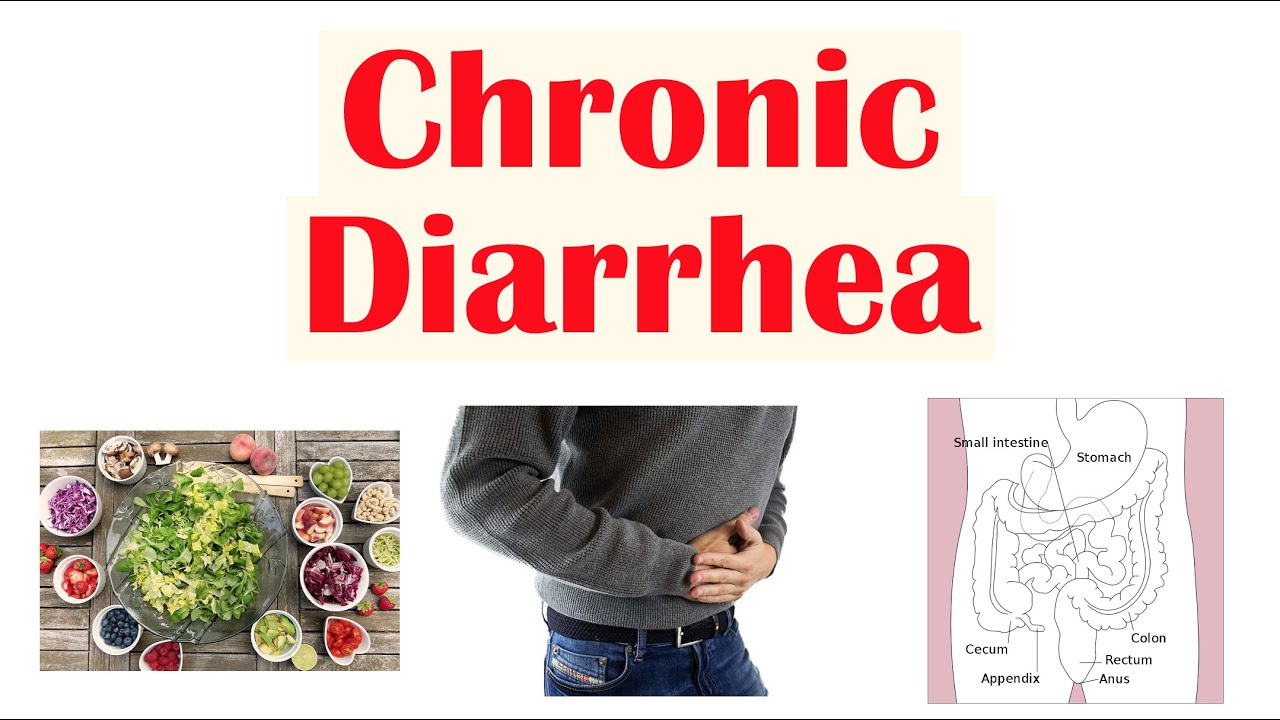 Chronic Diarrhea: Approach to Cause, Secretory vs Osmotic vs Inflammatory, Watery vs Bloody Diarrhea