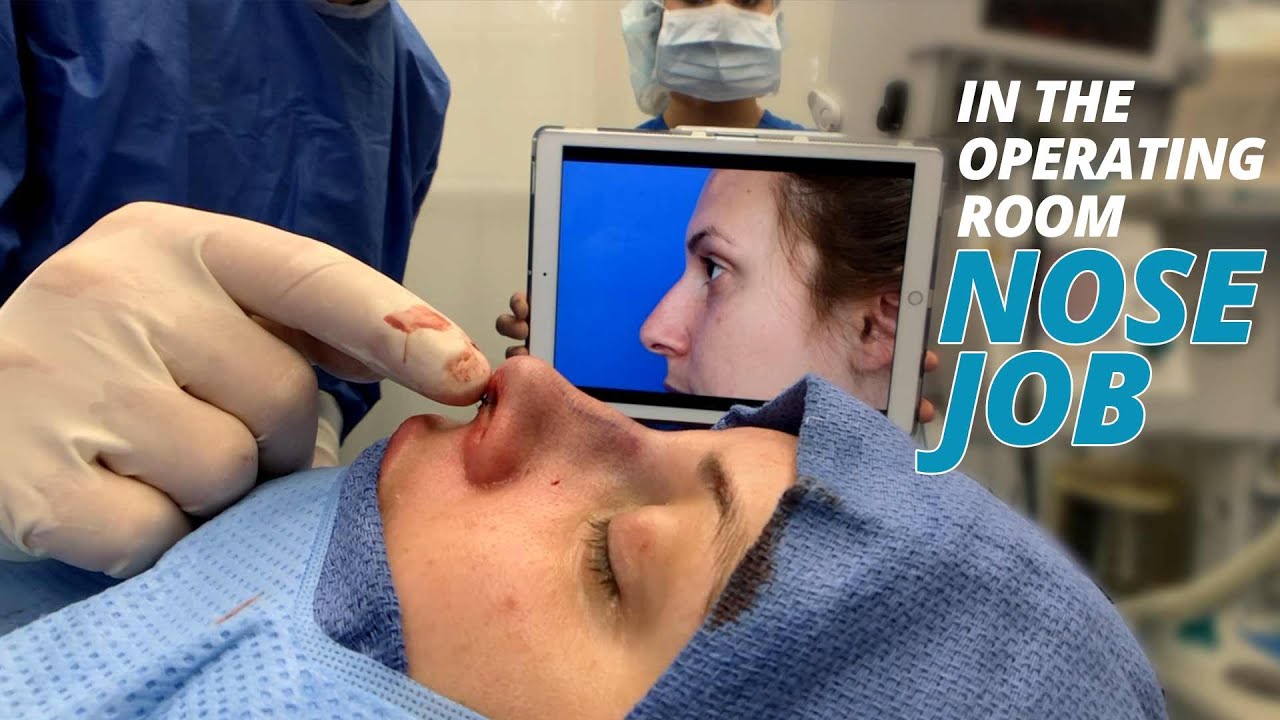 nose job surgery footage (ın the operatıng room)