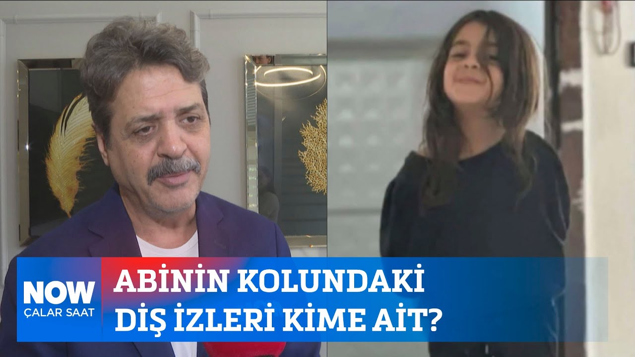 Abinin kolundaki diş izleri kime ait 