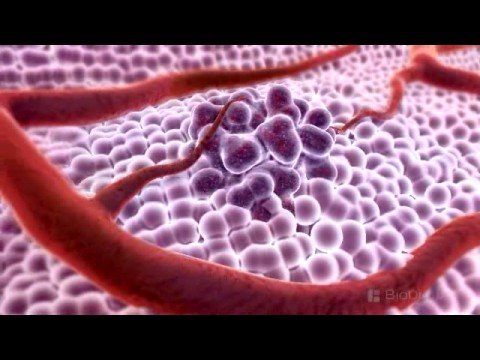 3D MEDİCAL ANİMATİON - WHAT İS CANCER?