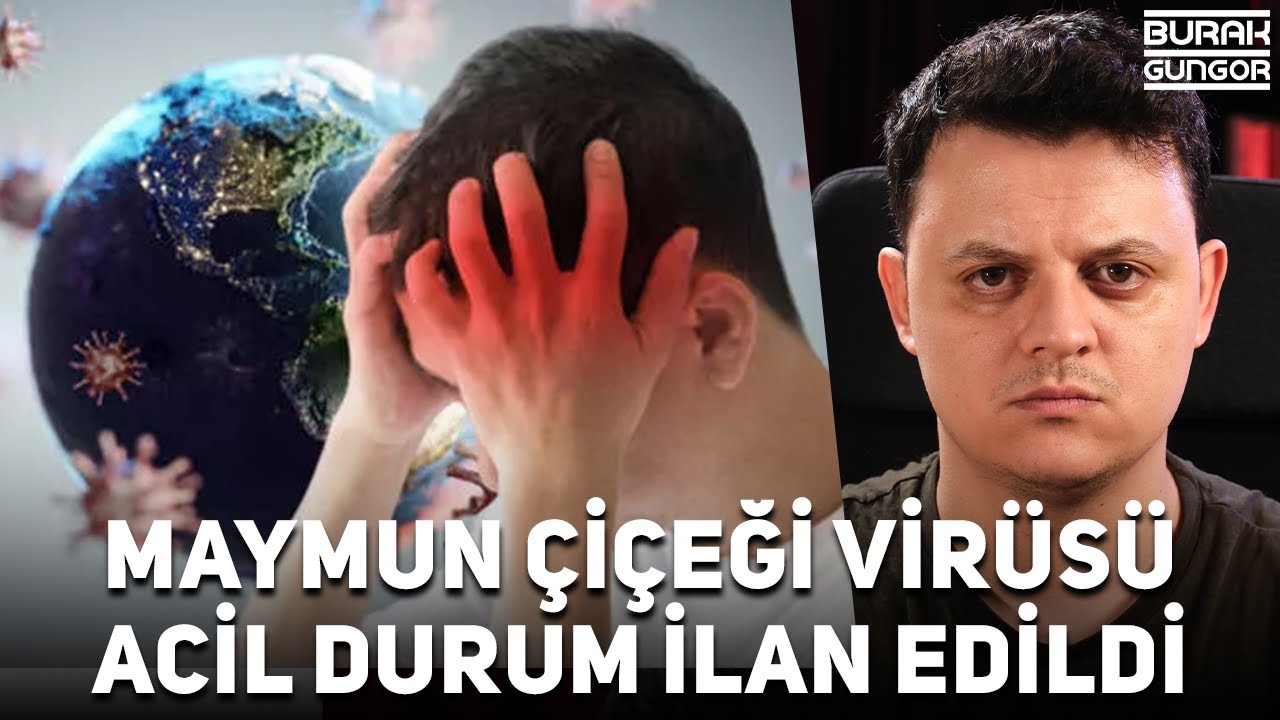 maymun çiçeği virüsü