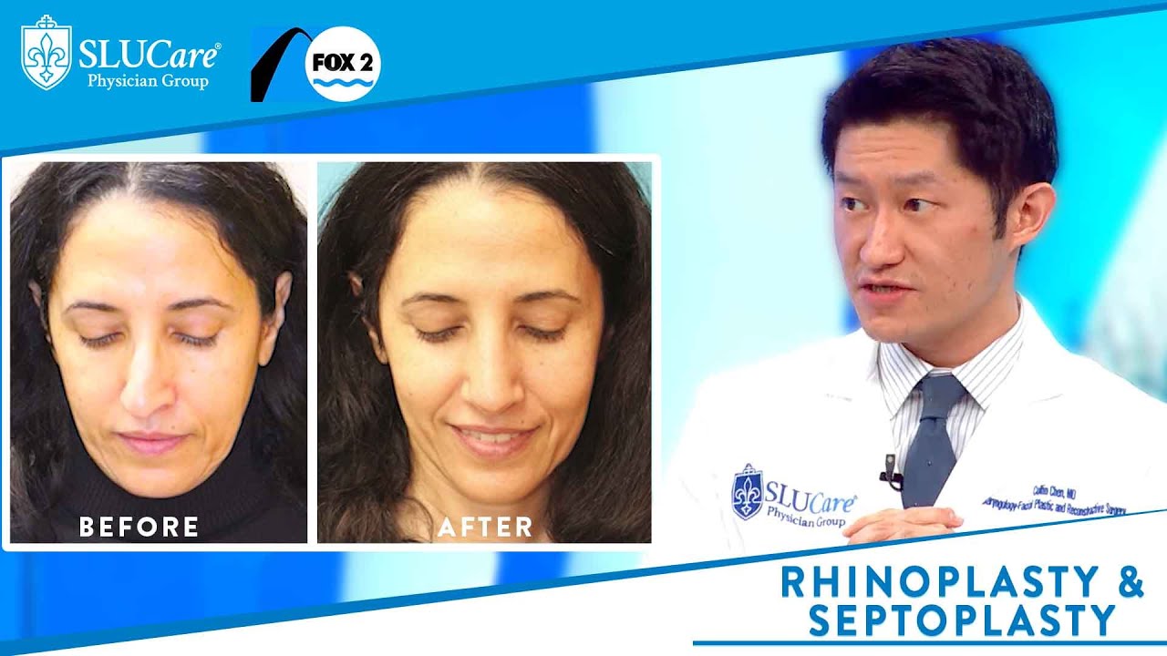 Rhinoplasty vs Septoplasty: Better Breathing and Reshaping the Nose - Fox 2