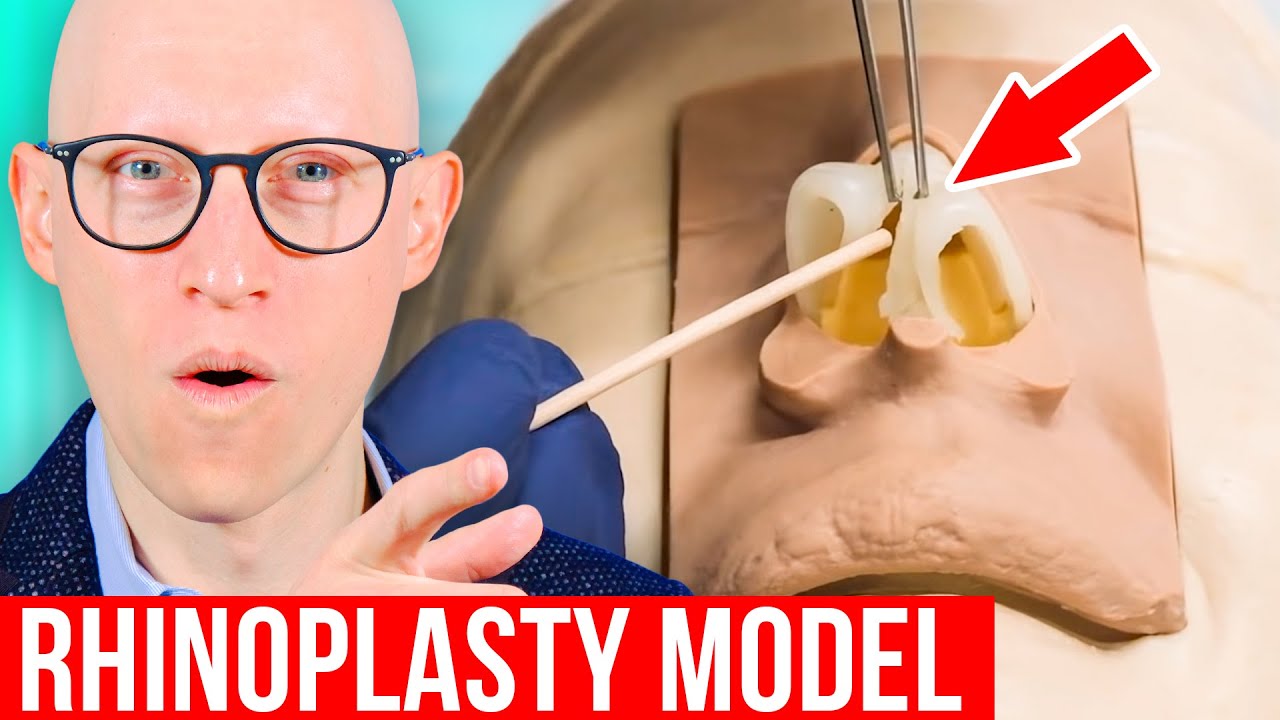 rhınoplasty explained by plastic surgeon
