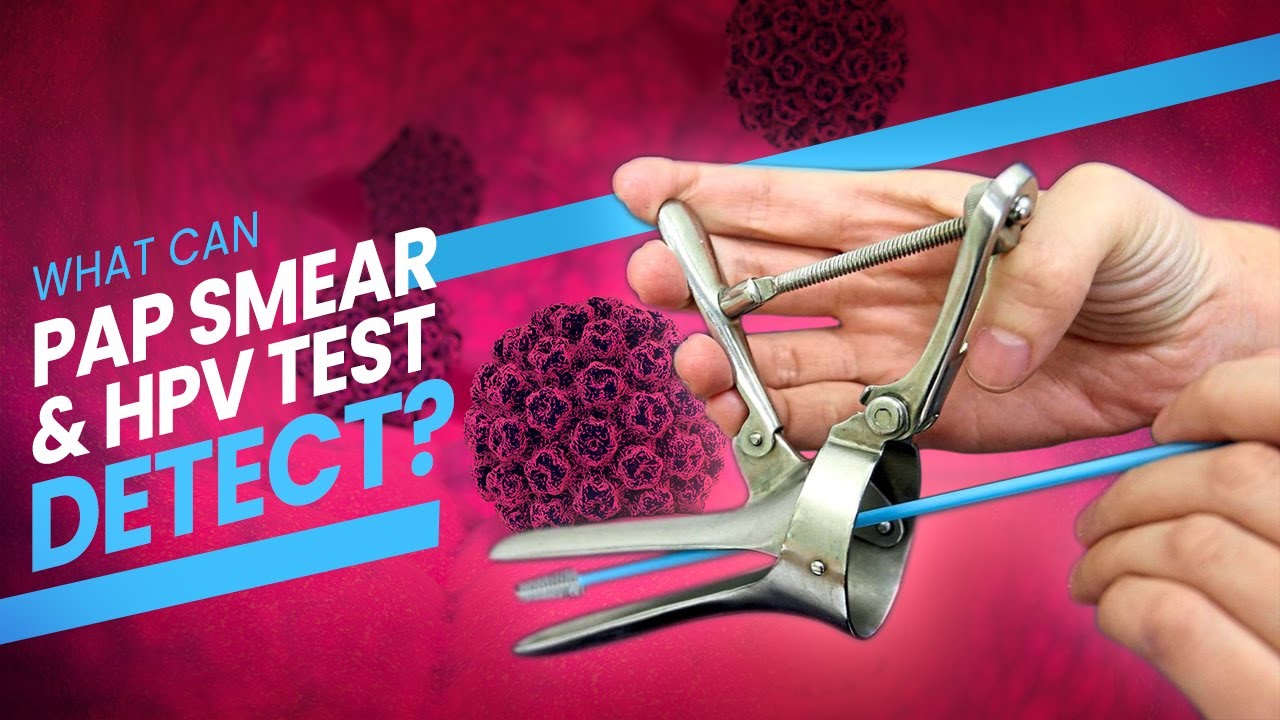 Pap Smear  Pap Test and HPV Test   A step by step guide  D at what happens during the test