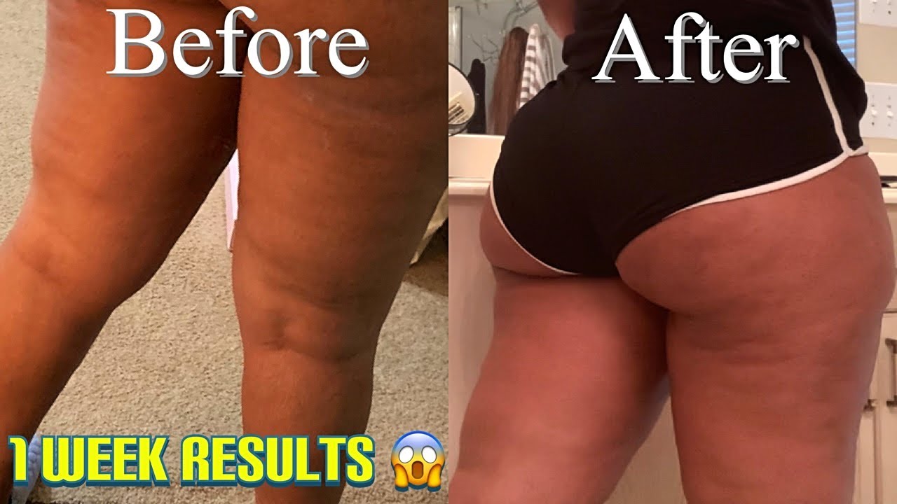 HERE'S HOW I SMOOTHED MY THIGHS IN A WEEK!! | TRULY BEAUTY | GİNA JYNEEN