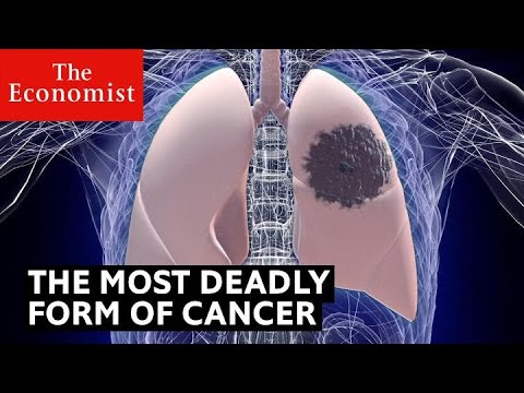 How to detect the deadliest form of cancer