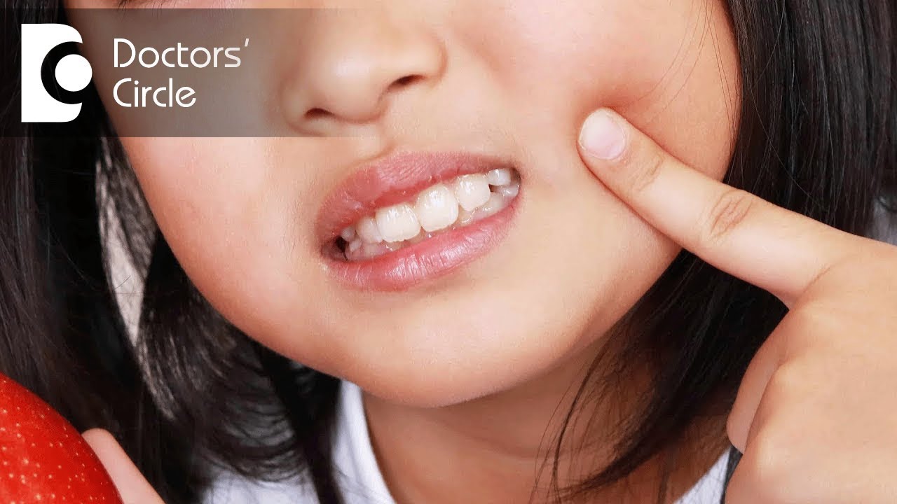 Which painkillers are safe for kids having toothache? - Dr. Arundati Krishnaraj