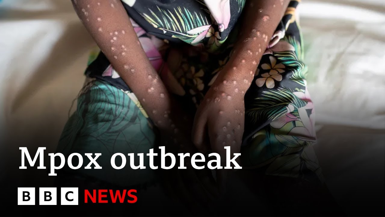 What is mpox and how is it spread    BBC News