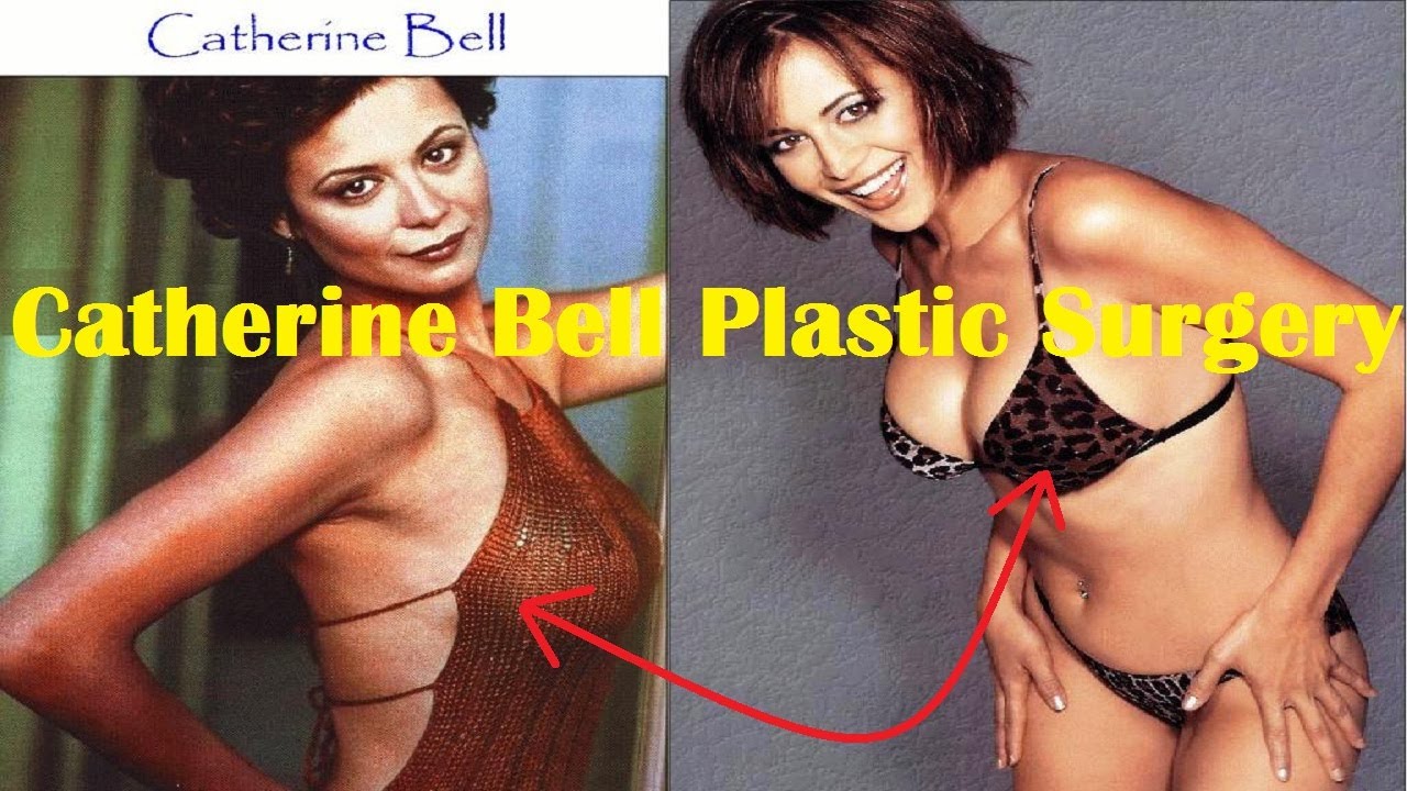 Catherine Bell Plastic Surgery | Before and After