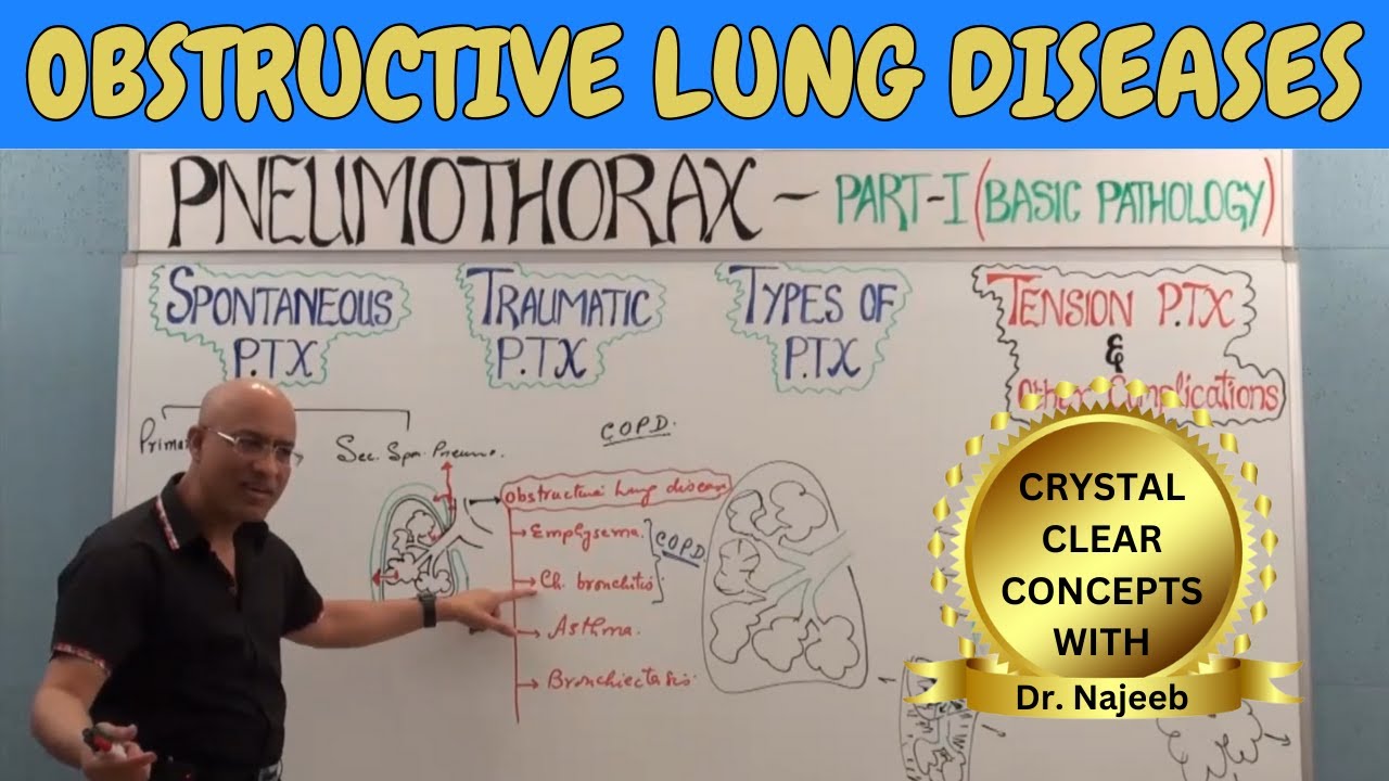 Obstructive Lung Diseases | COPD, Chronic Bronchitis, Asthma, Bronchiectasis & Emphysema????