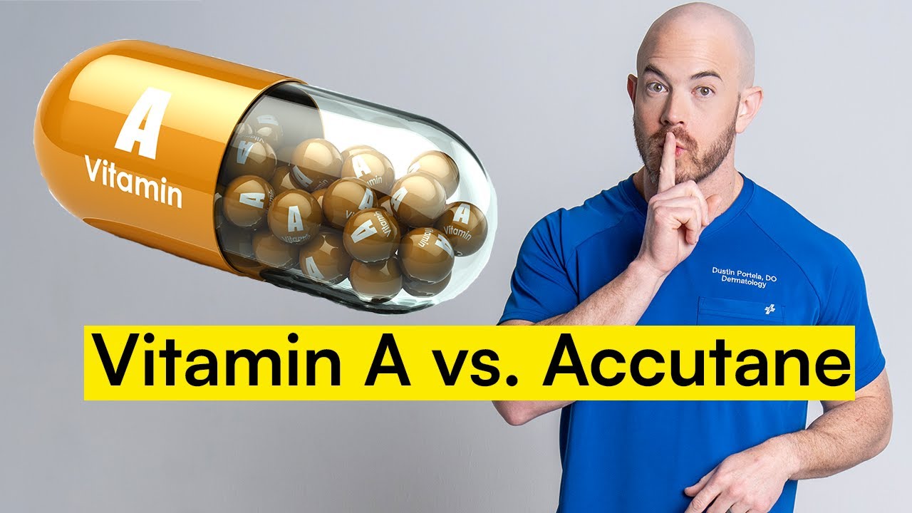 Vitamin A in the Treatment of Acne - What Does the Data Say?