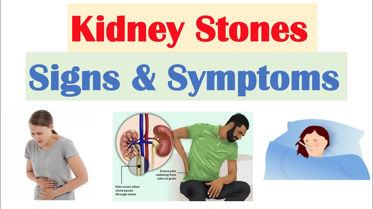 KİDNEY STONES (NEPHROLİTHİASİS) SİGNS  SYMPTOMS |  WHY THEY OCCUR