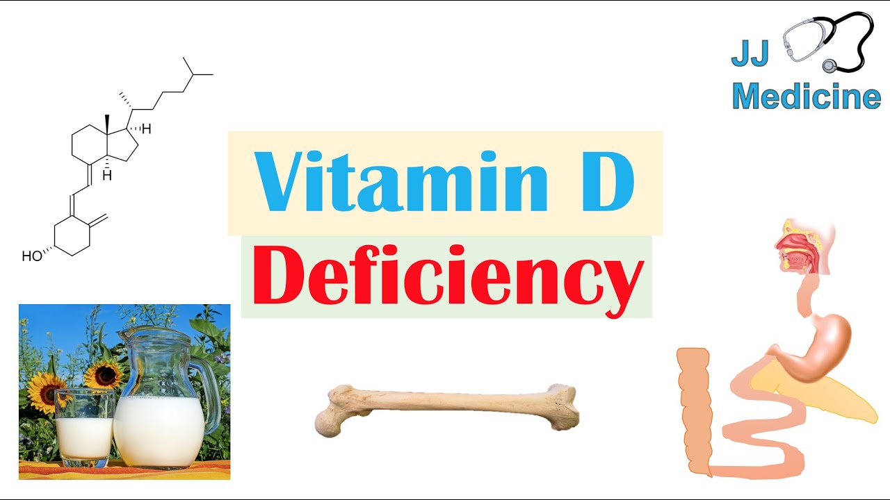 Vitamin D Deficiency | Absorption & Metabolism, Purpose of Vit D, Causes of Deficiency