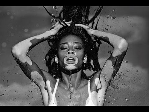 Chantelle Winnie Harlow Young Tribute ANTM Cycle 21 Canada